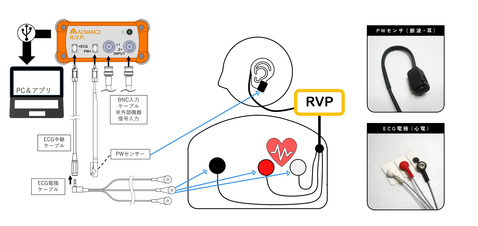 RVPの装置構成と装着例